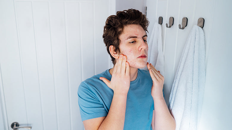 3 things every teenage boy needs in their skin care routine image